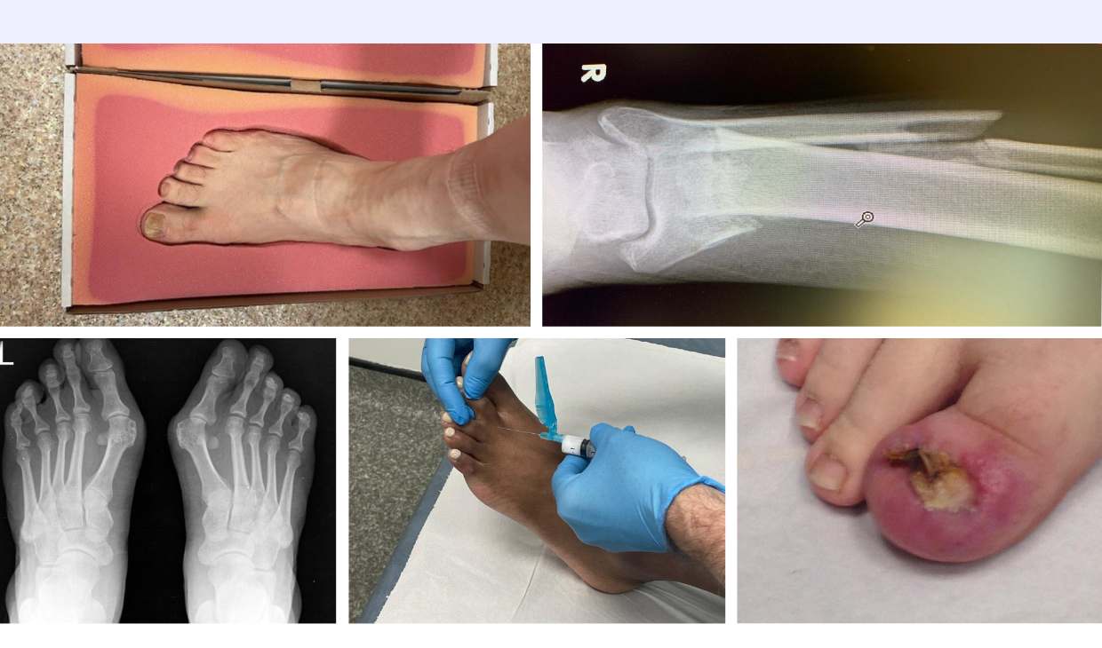 A collage of photographs covering the work of a podiatrist